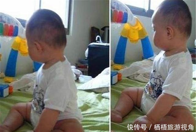 预防颈椎病|“睡枕头”和“不睡枕头”的孩子,长大后到底差别在哪里