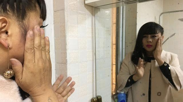 湿气|女人湿气重,身体三处会“变黄”,常喝四水,祛湿排毒一身轻