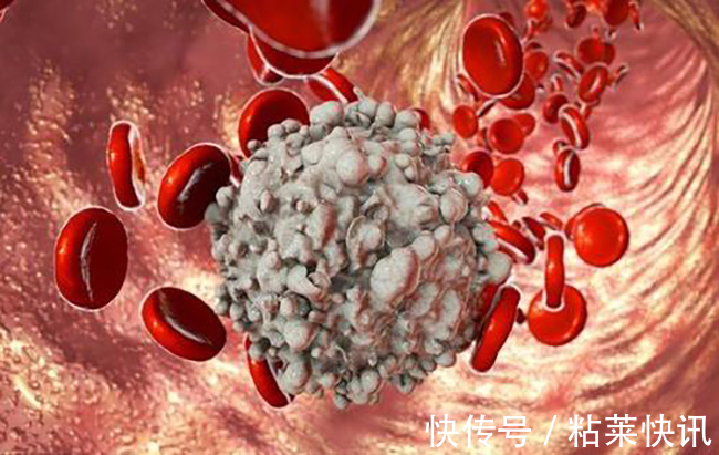 唐氏综合症日|世界唐氏综合症日关注被遗忘的天使,“唐宝宝”如何健康长大