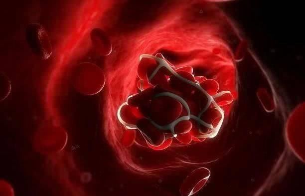 它是最便宜的血栓“溶剂”,伸手可拿,每天吃