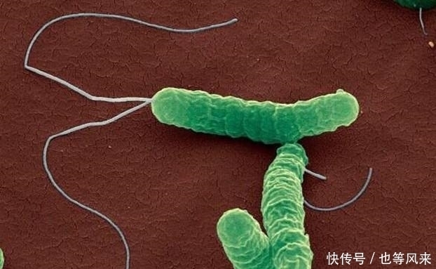 胃部有“幽门螺杆菌”,身体会有3个“改变”,细心一点就能发现