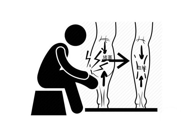 血液|血管软硬,腿脚告知!腿脚出现2个信号,或提醒你该保养血管了