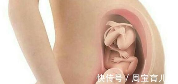 分娩|胎儿入盆前后孕肚形状有啥差异?出现两变,说明快卸货了