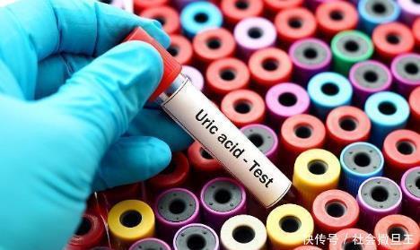 偷偷|尿酸高的人,哪些食物不可以吃看完以后,不要再偷偷的吃了