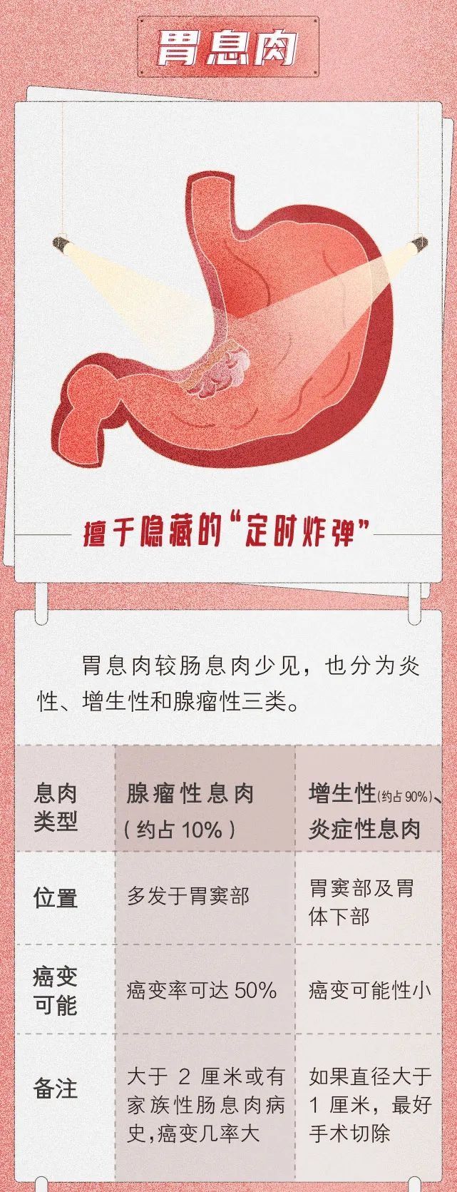 隐患|“小息肉”如何成为“大隐患”？不可忽视，该出手时就出手！