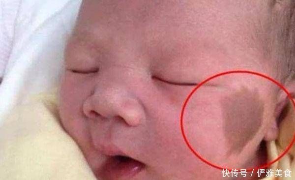 怀孕期间|怀孕期间,孕妇最好不要做这四件事,容易让宝宝将来有《胎记》