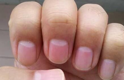 肝脏健康的人,手上会有这5个表现,如果你有,