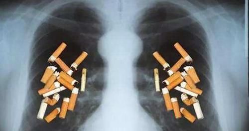  越来越|为什么肺癌患者越来越多？专家：除了抽烟外，还有5大诱因