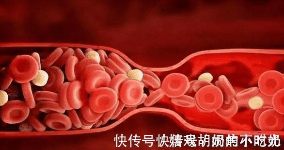 甘蓝|每天跑步可以降血脂？提醒：远离这3种蔬菜，血脂或会慢慢下降