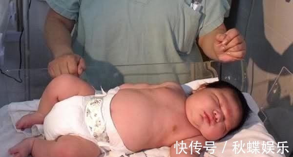 产妇|41岁高龄产妇竟产下17斤巨婴, 巨宝宝胃口更是大得让人咂舌