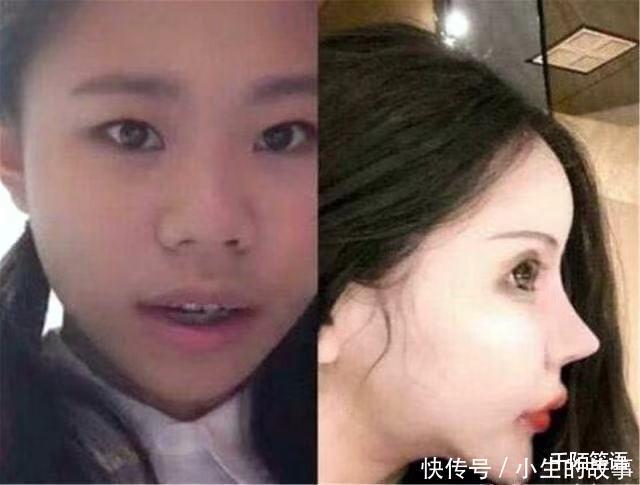 3年花费近百万,整了60次容的“网红”娜娜,现在过得怎么样