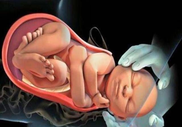 宫颈|顺产提及的“宫口十指”到底是啥概念？得知真相后，心疼顺产妈妈