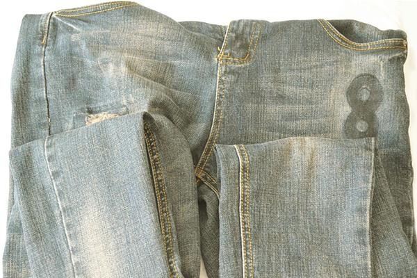 这种病|男童患白癜风,“祸首”竟是一条裤子?到底咋回事?家长要注意