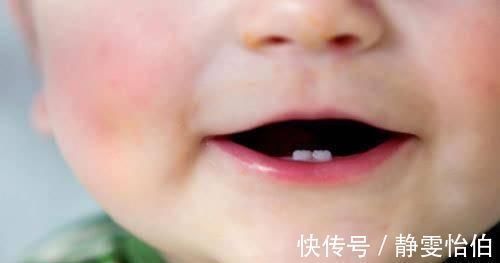 脱发|宝宝身体出现这几种现象,可能并不是“缺钙”,家长不要误会了