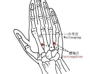  腰椎|手上有个“特效穴”，腰背疼痛就灸它！