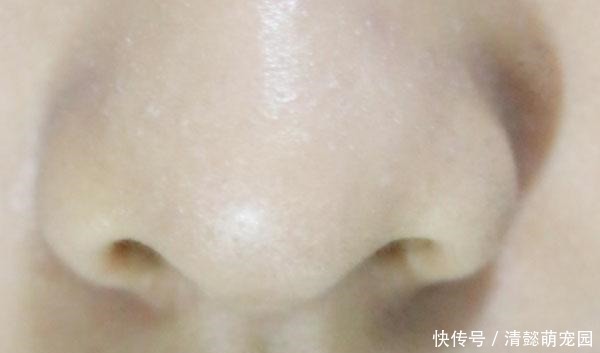 旺盛|为啥鼻毛长着长着,就会“窜”出来 鼻毛过于旺盛,说明了啥