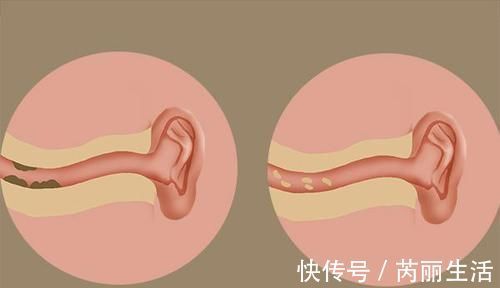 鼻屎白色粘稠怎么回事