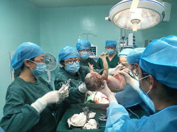 孕妇|顺产和剖腹产,哪种更遭罪听过来人怎么说的,选错受罪的是产妇