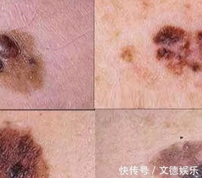 梗阻感|癌症靠近时,身体会如何呼救关键时刻,要读懂身体的求救信号