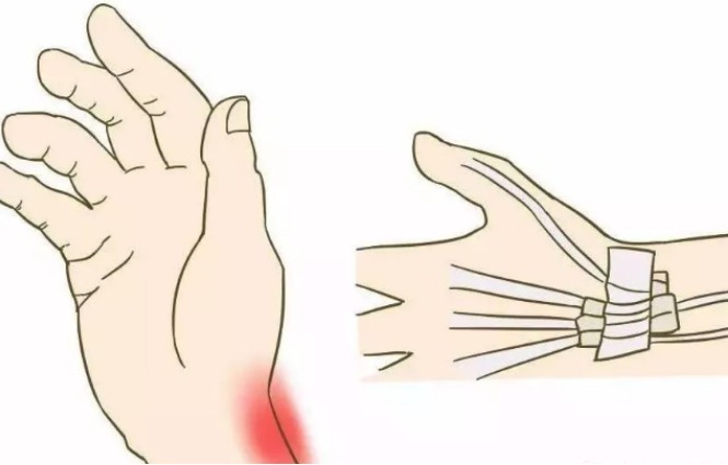 酸胀感|我们的身体上就有许多“止疼开关”,哪里痛按哪里,赶紧学一学!