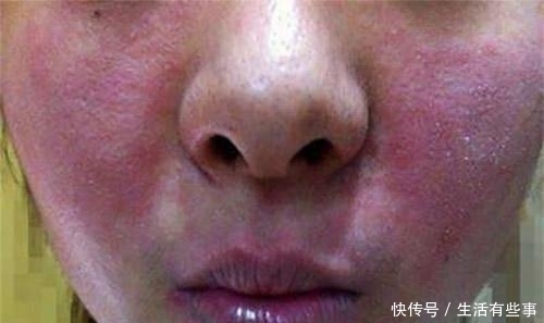 洗脸|体验香皂洗脸和洗面奶洗脸,2个月后,结局大不同