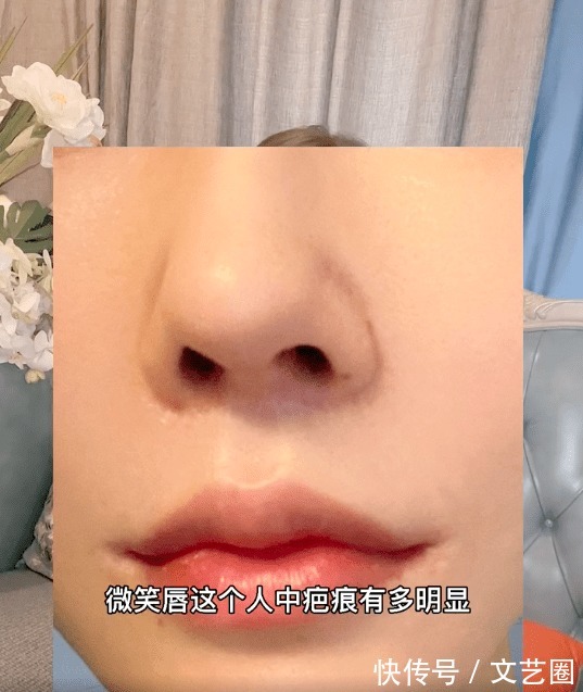 古尔|女网红整容失败揭医美行业黑幕:整容范本是“照骗”,医美托昧着良心赚钱