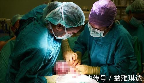 医生|同产房不同命一个15分钟,一个2小时后顺转剖,医生道出了原因