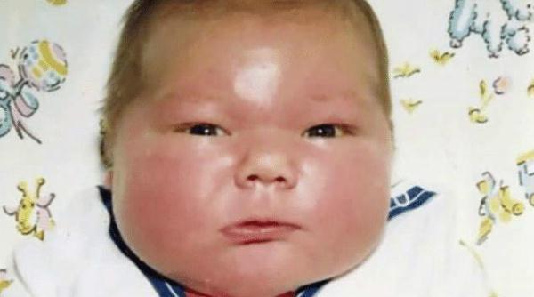 美国|37年前刚出生就是巨婴,体重到达14.5斤轰动全美国,现状如何?