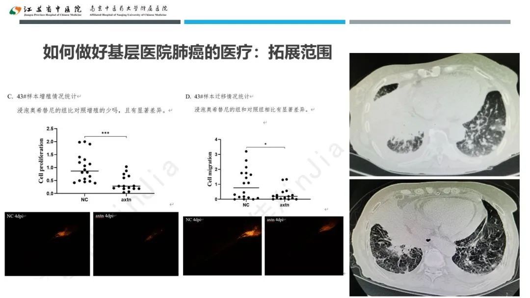 蔡婧|共谋江苏省基层医院肺癌未来发展之路