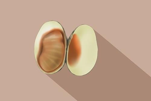 食物|尿酸高，不能吃木耳？专家：真正不能吃的食物，你可能没少吃