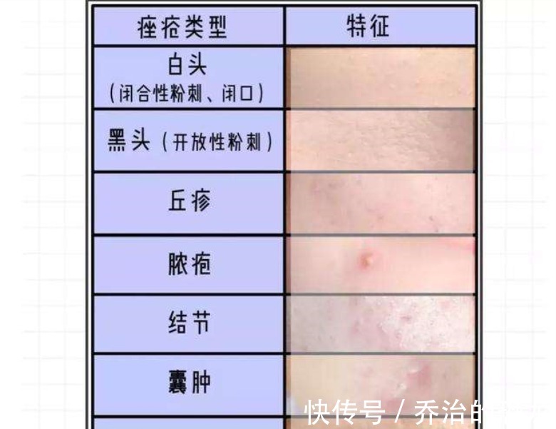 护肤|护肤品是智商税停用护肤品后皮肤会变好,这些护肤真相你不知道!