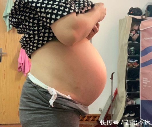 中期|准妈妈犯小错误,孕中期胎盘剥离,胎儿被引产