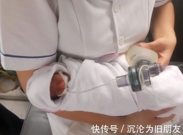 女婴|女子刚产下一个宝宝,14天后又生下一个娃!