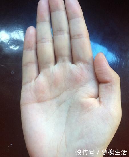 脚心|短命的人,多半身上有四处发白,若1个不占,恭喜身体健康易长寿