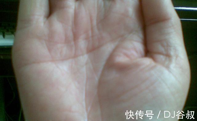 绿茶|你清楚“糖尿病”吗?如何降“血糖”?建议:常吃以下这5种食物