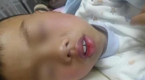 妈妈|儿子越长越像“大猩猩”,妈妈带去检查后,医生责问咋不早点来