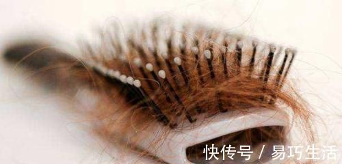 头发|除了头发经常清洗,还有梳子别忘了,满是油脂细菌不少