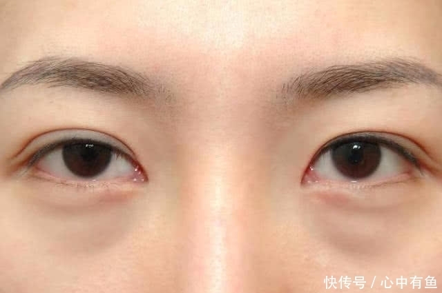 浮肿|晨起后,若你没出现4个“变化”,偷着乐吧,身体好着呢!