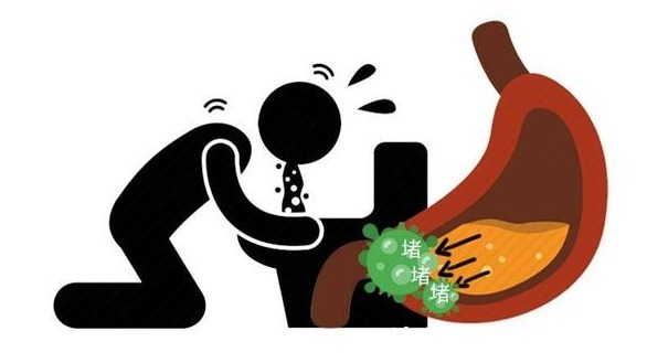 食物|肠胃有癌,吃饭先知?饭后出现这3种现象,别以为只是肠道不舒服