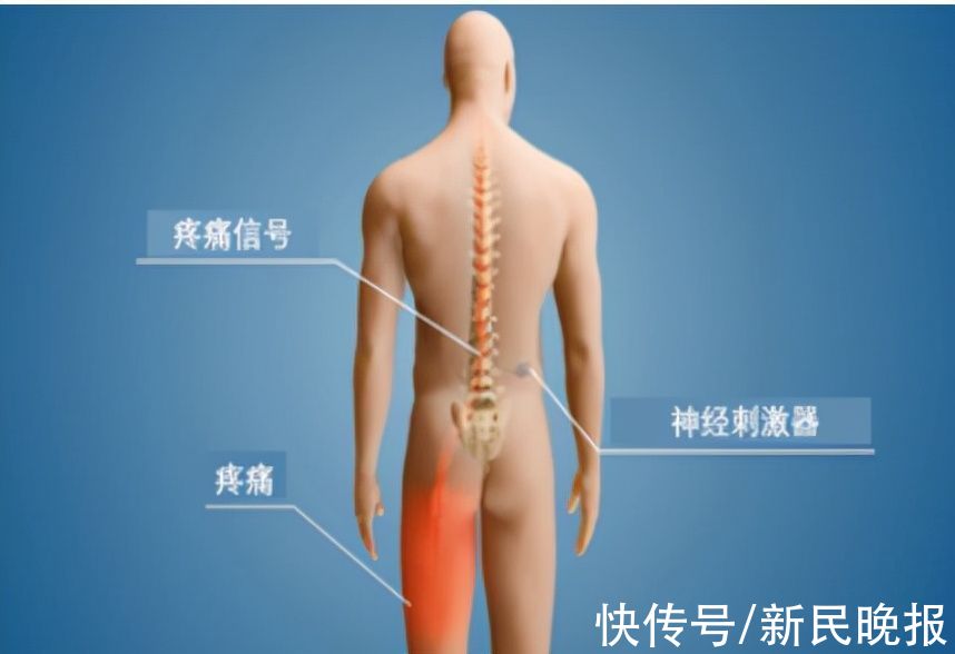 不当“忍者”，科学治痛|康健园 | 治痛