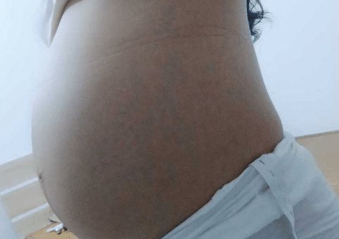 胎梦|“孕16周梦见蛇了,是什么影响”孕期胎梦暗示什么