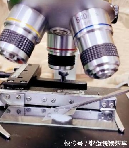 奶粉|“母乳”放大1000倍什么样?显微镜下会动,网友:世间最纯净东西