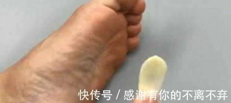 眉毛|用大蒜在眉毛上擦两下，可能发生这几个变化！看完记得收藏