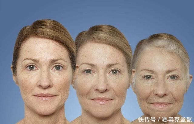 揭晓女人衰老的原因:运动第一,熬夜第二,第三大部分都不注重!