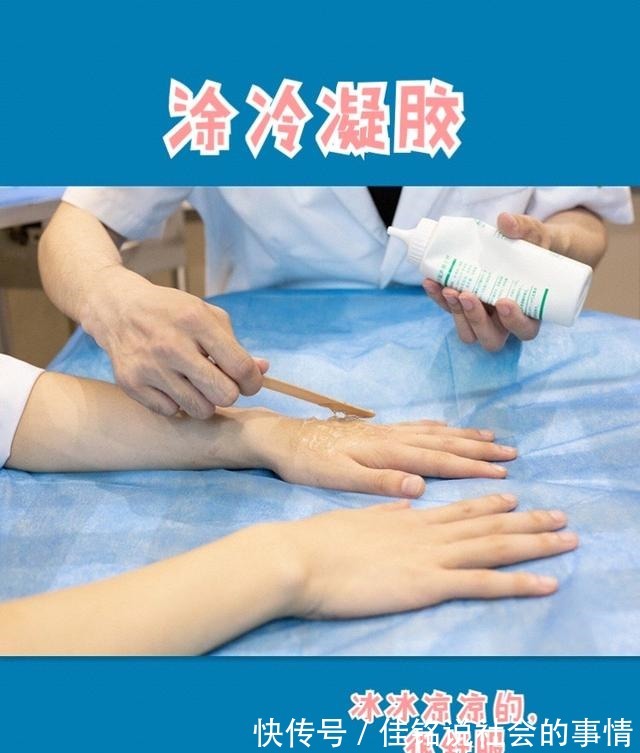 黑金超光子嫩肤 黑金超光子嫩肤真的是无痛的吗!