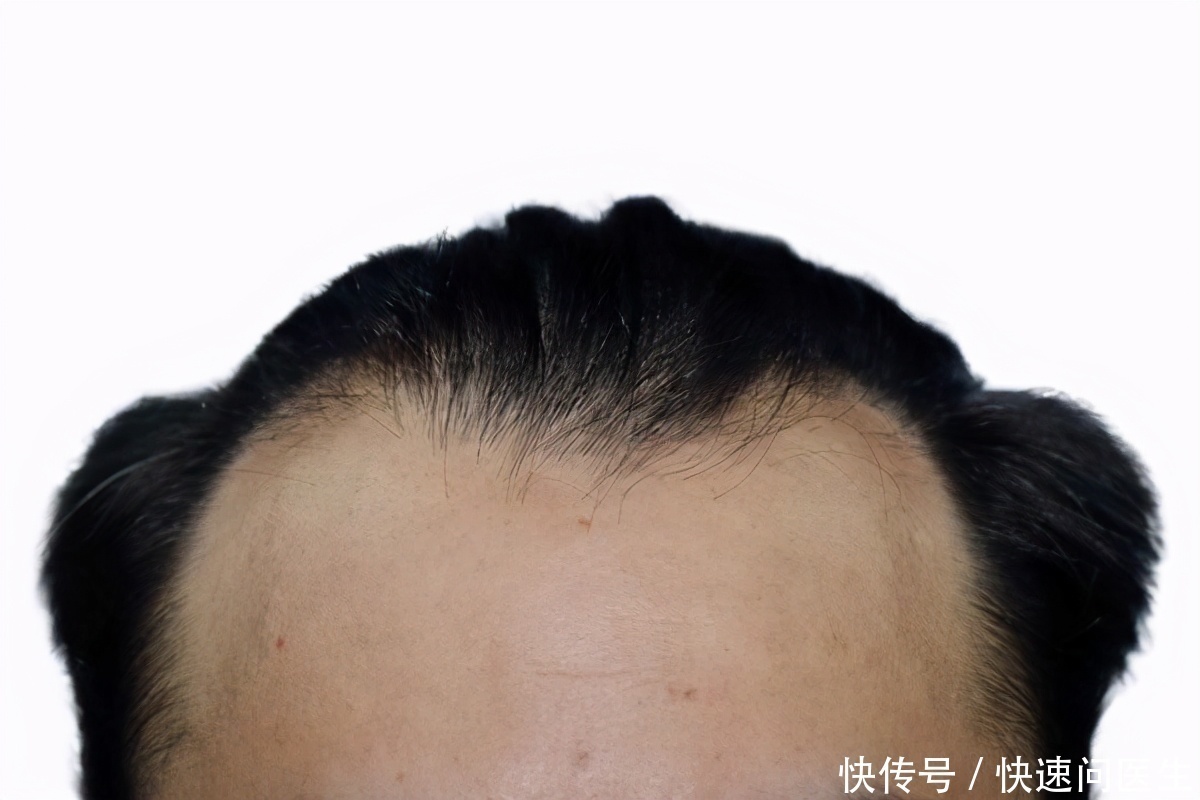 腹部|男人第一个衰老信号通常在腹部，出现肚子变大、便秘，要重视起来