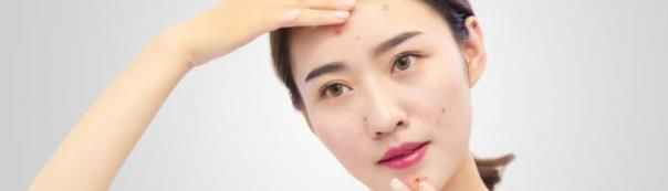 硫磺皂洗脸真的可以祛痘吗？不能，但有3个不为人知的好处！