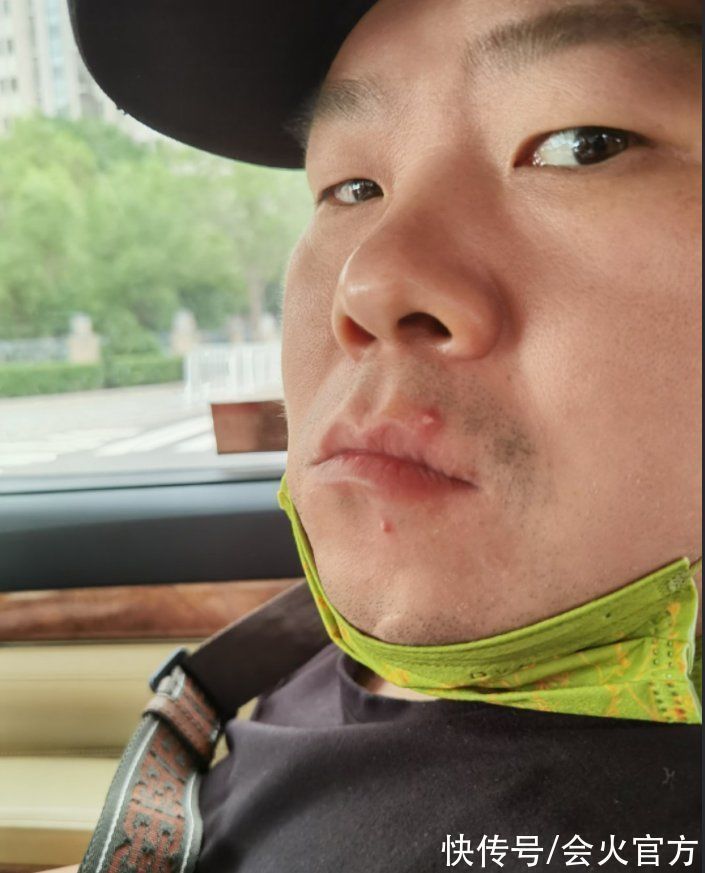 |36岁岳云鹏遛狗被拍!脚步轻快动作搞笑,8岁小女儿手提大包辣条