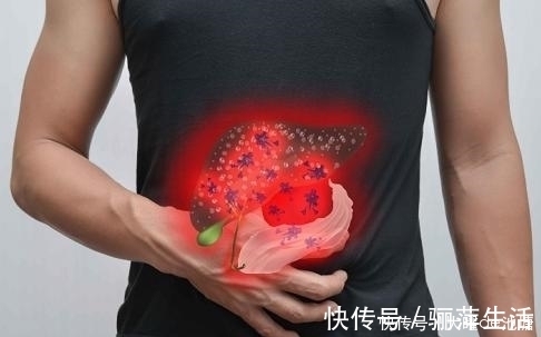 酒精肝|肝脏不好的人，4种食物要少吃，否则吃得越多肝病越严重！