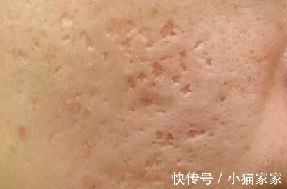 护肤品 哪些皮肤问题是护肤品不能解决的!